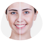 Home Anti-aging scar treatment