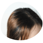 Home Dandruff control treatment